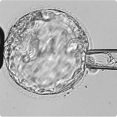 Biopsia de embrión