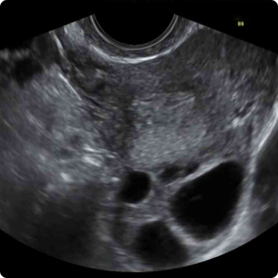 Control Folicular